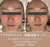 エステティックサロン さら