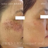 プライベートアイラッシュサロン ヴィレージュ 稲毛店(Vireijou)