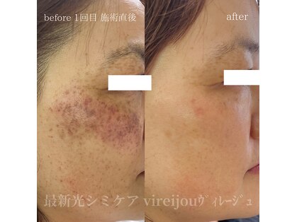 プライベートアイラッシュサロン ヴィレージュ 稲毛店(Vireijou)の写真