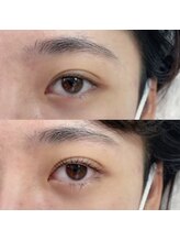 フランセス(Frances)/上下ラッシュリフト