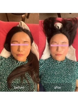 美容整体サロン プライム(Prime)/小顔矯正　ビフォーアフター