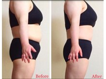 ユーフルール/お腹のお肉ごっそり落ちた！