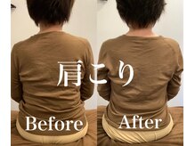 整骨院 整体院 ユールーム 周南支店(YOUROOM)/【肩こり】