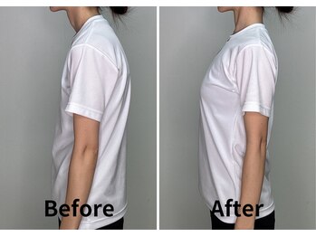 サンク(Cinq)/【整体】ストレートネック改善