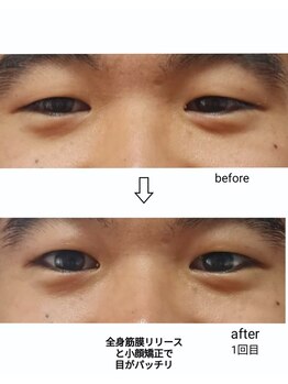 エム(M)/整体 小顔矯正