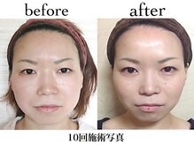 小顔整体研究所 KSラボ 富山店