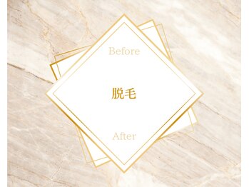 リーフ(Leaf.)/脱毛