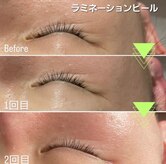 マロン(MARON)