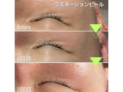 マロン(MARON)の写真