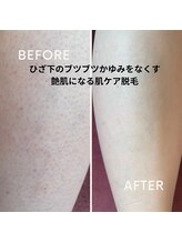 スウィートボディ(Sweetbody)/ブツブツ毛穴がツルスベなお肌に