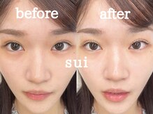 スイ(SUI)/まつ毛パーマ