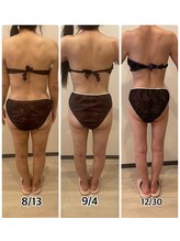 インディバジェム(GEM)/ビフォーアフター