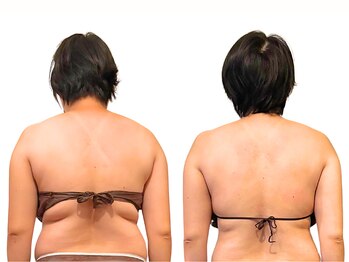 癒和(YUWA)/根本改善でリバウンド知らずの体