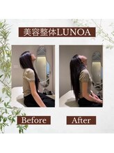 美容整体LUNOA　神戸三宮院/[三ノ宮/美容整体/整体/肩こり]