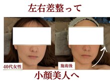 メディカモン(medikamon)の雰囲気(左右差を整えてフェイスラインすっきり◎小顔美人へ☆)