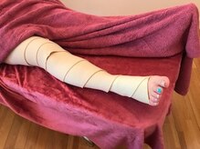 エステティック ジェミー(ESTHTETIQUE Gemmy)/バンテージ