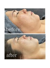 ミュアン(La Mueien)/くすみ・むくみはその日のうちに