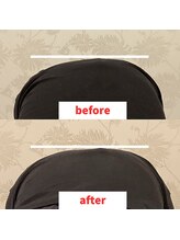 ナオル整体 福岡香椎院(NAORU整体)/20代女性施術事例【側湾改善】