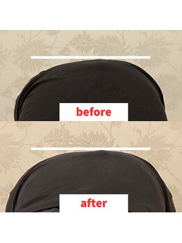 ナオル整体 福岡香椎院(NAORU整体)/20代女性施術事例【側湾改善】