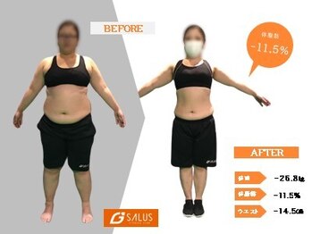 ジーサルース(Gサルース)/S様（３０代）【６カ月】　前