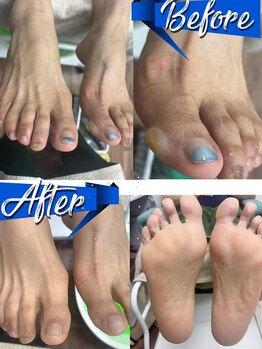 ジェイリン美容サロン/フットスパとペディキュア