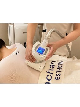 サイズダウンを目指したい