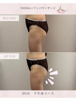 スーペリオル(Superior)/浮腫み・冷えを根本から改善