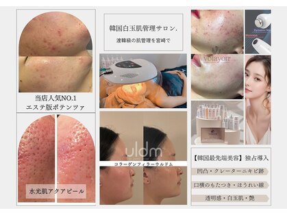 ヴィエルバ(VIELVA)の写真