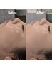 【産毛×角質除去で毛穴レス肌】艶肌ワックス+高保湿鎮静ケア
