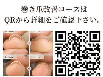 クオン(KUON)/巻き爪改善コース