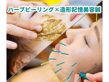 ディア(Deer)/小顔美容鍼＋ハープピーリング