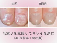 ココデネイル(cocode nail)