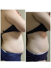 ブリリアント(Brilliant)/お腹周り通い放題！