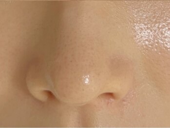 ランドエヌ(RAND.N)の写真/【岩手初導入！韓国肌管理セラピール】韓国女優肌メニューでお肌負担なしのぷるツヤ肌に♪