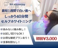 エヌエーホワイトニング たまプラーザ店(NA whitening)