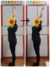 カイロプラクティックひまわり/カイロで姿勢改善！！！