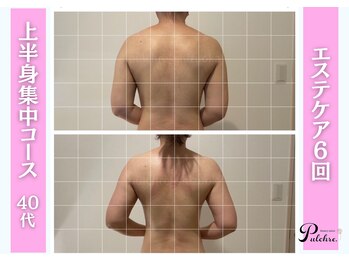 プルクレ 常磐町店(Pulchre)/ダイエットコース♪40代