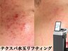 弱肌さん◎→【赤み/凹凸/敏感肌】水玉リフティングテクスパ 30,000→14,800
