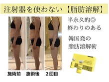 イーズ ミュゼ  ららぽーと横浜店の雰囲気（話題沸騰!韓国発!【レモンボトル】小顔/毛穴ケア/たるみ半永久的）