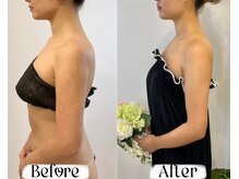 ソウ バイ ソウ(So by 蒼)/駆け込みの花嫁様。１回で激変！