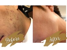 カズキハギワラ(Kazuki Hagiwara)