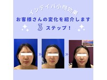 プリマヴェーラ(PRIMAVERA)の雰囲気（エラ、食いしばり解消♪自慢な小顔フェイシャル）