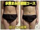 ヨサパーク ポノレア(YOSA PARK PONO-LEA)の写真/水素とルルオンでスピードダイエット！