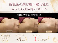 ヴェルナ(VELUNA)