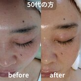 コールドゥ(Coeur-Doux)