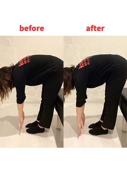 ナオル整体 福岡香椎院(NAORU整体)/30代女性施術事例【腰の痛み】