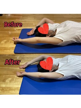 ファゴッド(FaGOD)/施術写真♪