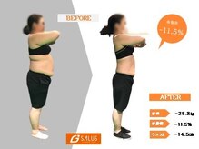 ジーサルース(Gサルース)/S様（３０代）【６カ月】　横