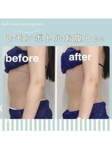 ハロ 南青山(HALO)/レモンボトルお腹ウエスト８cc