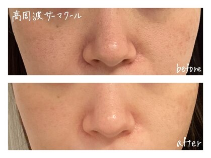 ミースプラス(me,as+)の写真